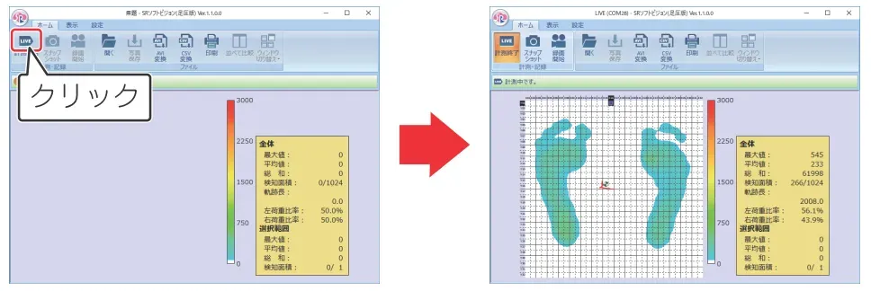SRソフトビジョン足圧版　らくらく操作.webp