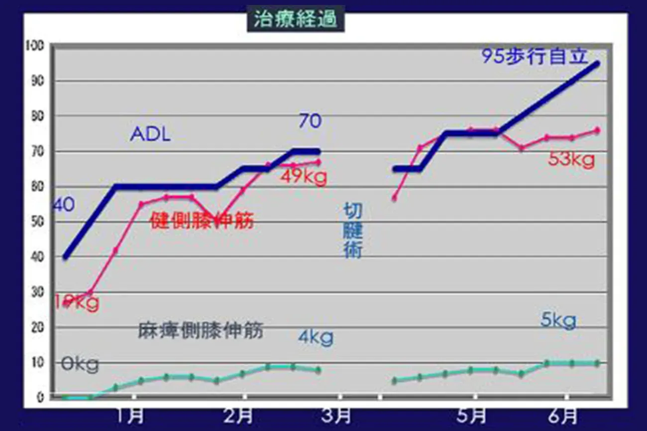 高齢者のリハビリ_サムネ.webp