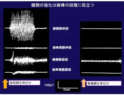 高齢者のリハビリ_3.webp