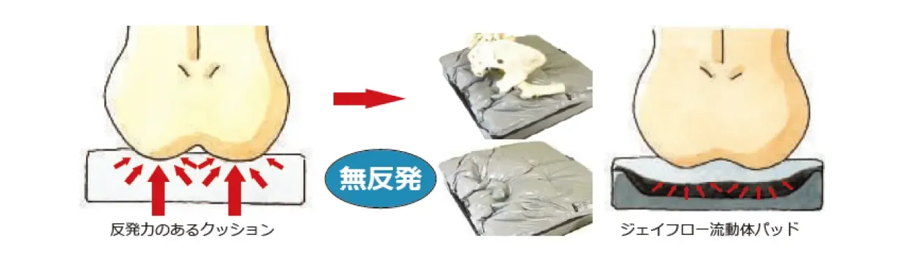 シーティングとポジショニング JAY 床ずれ(褥瘡)の予防と再発防止.webp